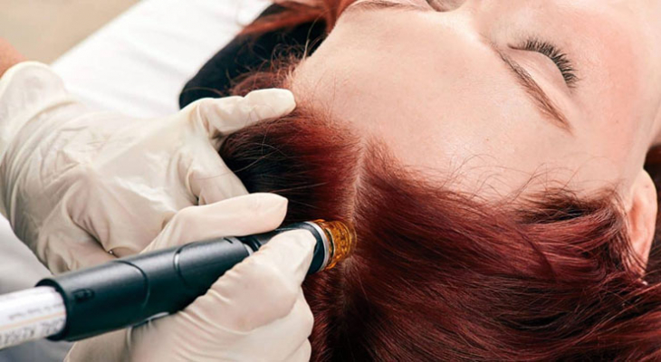 Здравата хидратирана и балансирана кожа на скалпа е не по малко